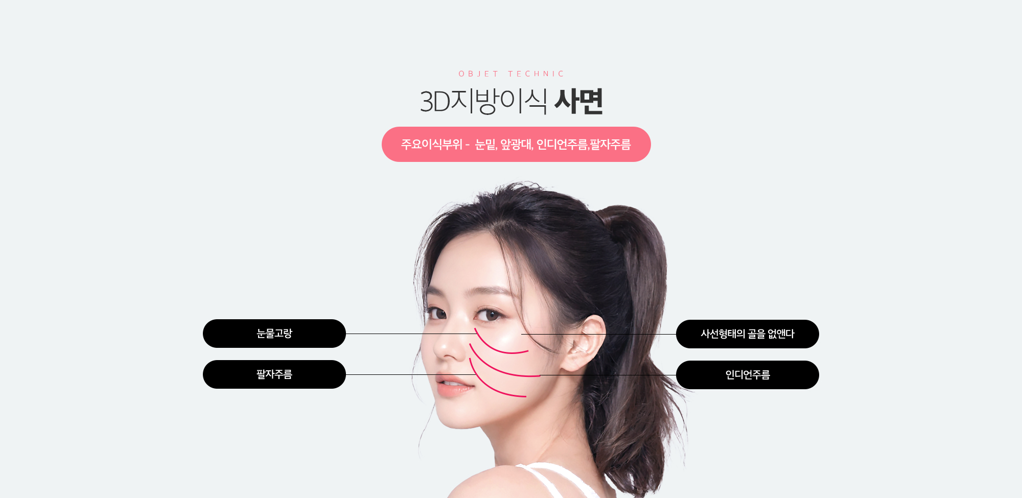 3D지방이식 사면 사선형태의 골을 없앤다