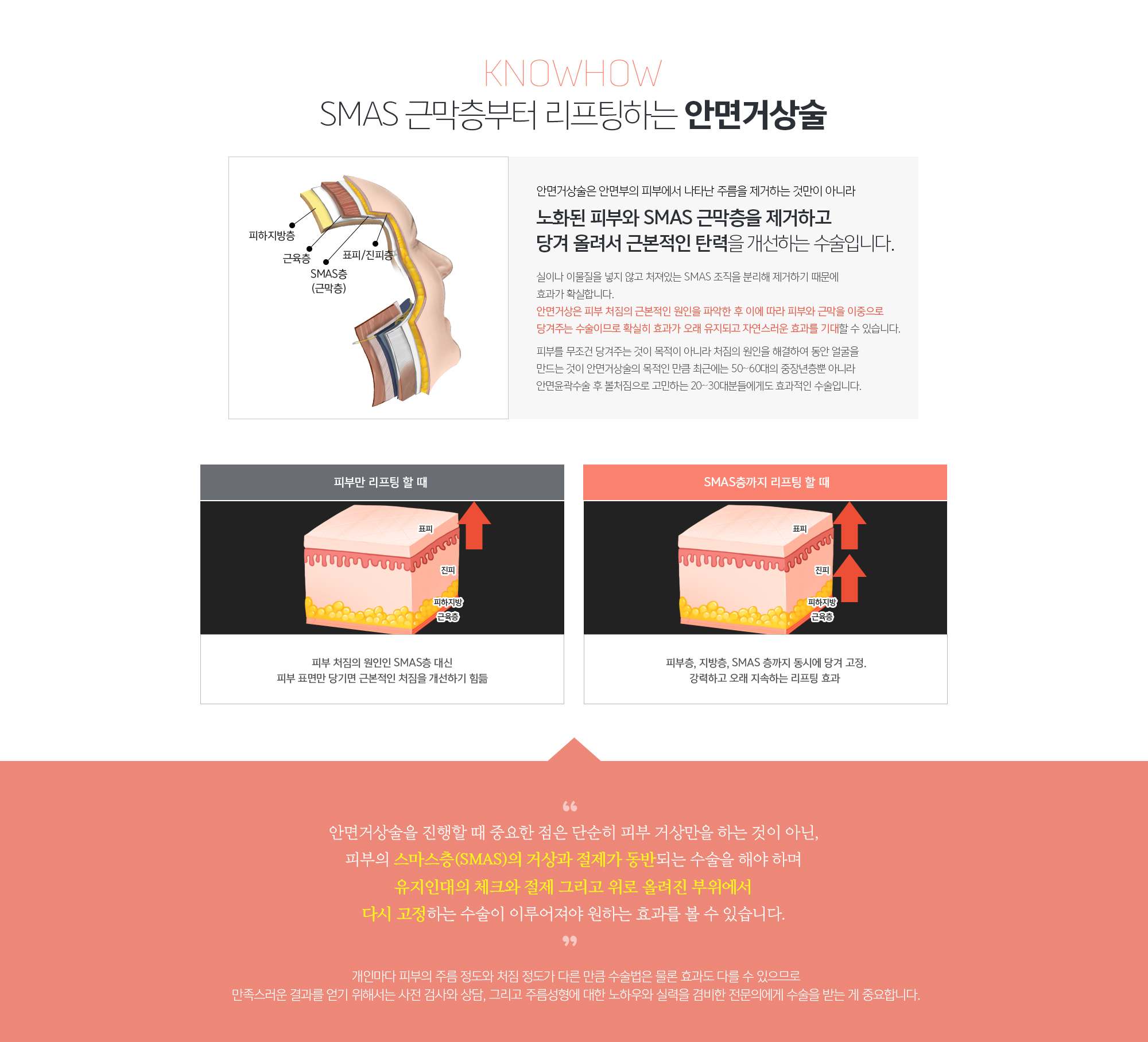 SMAS 근막층부터 리프팅하는 안면거상술 
	안면거상술은 안면부의 피부에서 나타난 주름을 제거하는 것만이 아니라 
	노화된 피부와 SMAS 근막층을 제거하고 당겨 올려서 
	근본적인 탄력을 개선하는 수술입니다. 
	실이나 이물질을 넣지 않고 처져있는 SMAS 조직을 분리해 제거하기 때문에 효과가 확실합니다. 안면거상은 피부 처짐의 근본적인 원인을 파악한 후 이에 따라 피부와 근막을 이중으로 당겨주는 수술이므로 확실히 효과가 오래 유지되고 자연스러운 효과를 기대할 수 있습니다. 
	피부를 무조건 당겨주는 것이 목적이 아니라 처짐의 원인을 해결하여 동안 얼굴을 만드는 것이 안면거상술의 목적인 만큼 최근에는 50~60대의 중장년층뿐 아니라 안면윤곽수술 후 볼처짐으로 고민하는 20~30대분들에게도 효과적인 수술입니다. 
	
	안면거상술을 진행할 때 중요한 점은 단순히 피부 거상만을 하는 것이 아닌, 
	피부의 스마스층(SMAS)의 거상과 절제가 동반되는 수술을 해야 하며 
	유지인대의 체크와 절제 그리고 위로 올려진 부위에서 
	다시 고정하는 수술이 이루어져야 원하는 효과를 볼 수 있습니다. 
	개인마다 피부의 주름 정도와 처짐 정도가 다른 만큼 수술법은 물론 효과도 다를 수 있으므로 만족스러운 결과를 얻기 위해서는 사전 검사와 상담, 그리고 주름성형에 대한 노하우와 실력을 겸비한 전문의에게 수술을 받는 게 중요합니다.
	