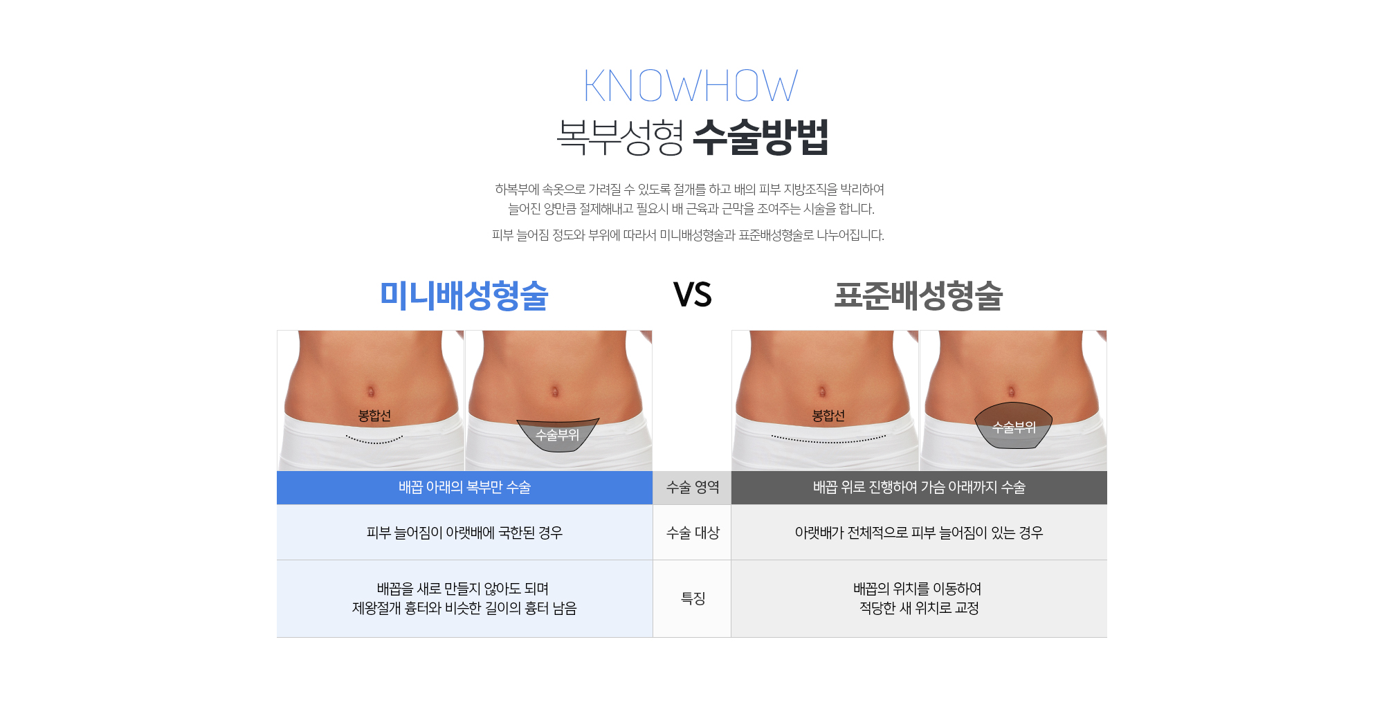 복부성형 수술대상
	1. 임신과 출산으로 인해 뱃살이 늘어진 경우
	2. 급격한 체중 조절로 피부 탄력이 떨어진 경우
	3. 지방흡입 후 복부가 늘어진 경우
	4. 운동을 해도 처진 뱃살이 빠지지 않는 경우
	