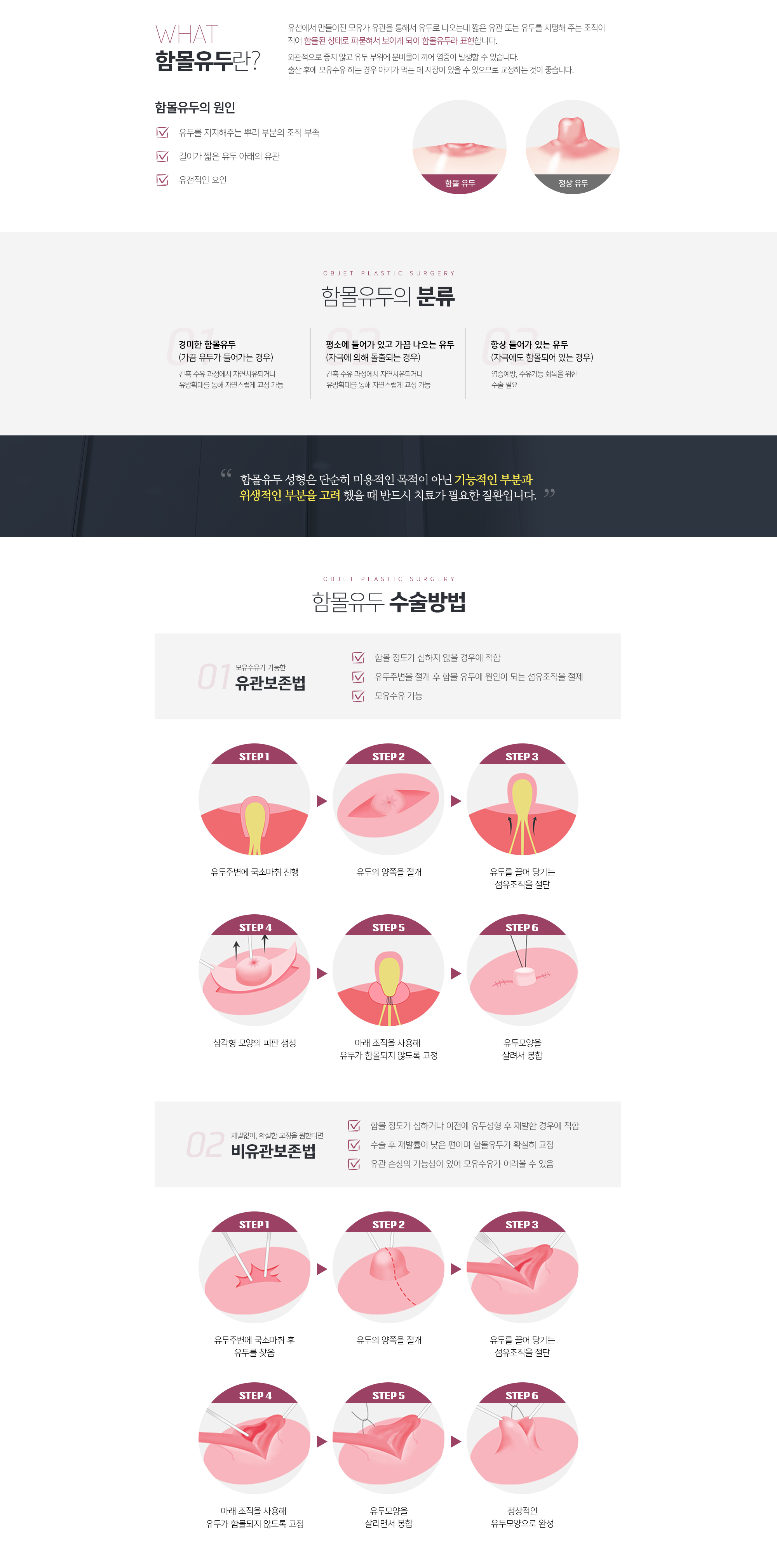 함몰유두란? 
				유선에서 만들어진 모유가 유관을 통해서 유두로 나오는데 
				짧은 유관 또는 유두를 지탱해 주는 조직이 적어 함몰된 상태로 
				파묻혀서 보이게 되어 함몰유두라 표현합니다. 
				외관적으로 좋지 않고 유두 부위에 분비물이 끼어 염증이 발생할 수 있습니다. 출산 후에 모유수유 하는 경우 아기가 먹는 데 지장이 있을 수 있으므로 교정하는 것이 좋습니다. 

				함몰유두의 원인
				1. 유두를 지지해주는 뿌리 부분의 조직 부족
				2. 길이가 짧은 유두 아래의 유관
				3. 유전적인 요인

				함몰유두의 분류
				경미한 함몰유두 
				(가끔 유두가 들어가는 경우)
				간혹 수유 과정에서 자연치유되거나 
				유방확대를 통해 자연스럽게 교정 가능

				평소에 들어가 있고 가끔 나오는 유두 (자극에 의해 돌출되는 경우)
				간혹 수유 과정에서 자연치유되거나 유방확대를 통해 자연스럽게 교정 가능

				항상 들어가 있는 유두 
				(자극에도 함몰되어 있는 경우)
				염증예방, 수유기능 회복을 위한 수술 필요

				함몰유두 성형은 단순히 미용적인 목적이 아닌 기능적인 부분과 
				위생적인 부분을 고려 했을 때 반드시 치료가 필요한 질환입니다.
				
				함몰유두 수술방법
				1. 유관보존법
				함몰 정도가 심하지 않을 경우에 적합
				유두주변을 절개 후 함몰 유두에 원인이 되는 섬유조직을 절제
				모유수유 가능

				유두주변에 국소마취 진행 
				유두의 양쪽을 절개
				유두를 끌어 당기는 섬유조직을 절단
				삼각형 모양의 피판 생성
				아래 조직을 사용해 
				유두가 함몰되지 않도록 고정
				유두모양을 살려서 봉합

				2. 비유관보존법
				함몰 정도가 심하거나 이전에 유두성형 후 재발한 경우에 적합
				수술 후 재발률이 낮은 편이며 함몰유두가 확실히 교정
				유관 손상의 가능성이 있어 모유수유가 어려울 수 있음
				유두주변에 국소마취 후 유두를 찾음
				유두의 양쪽을 절개
				유두를 끌어 당기는 섬유조직을 절단
				아래 조직을 사용해 유두가 함몰되지 않도록 고정
				유두모양을 살리면서 봉합
				정상적인 유두모양으로 완성
				