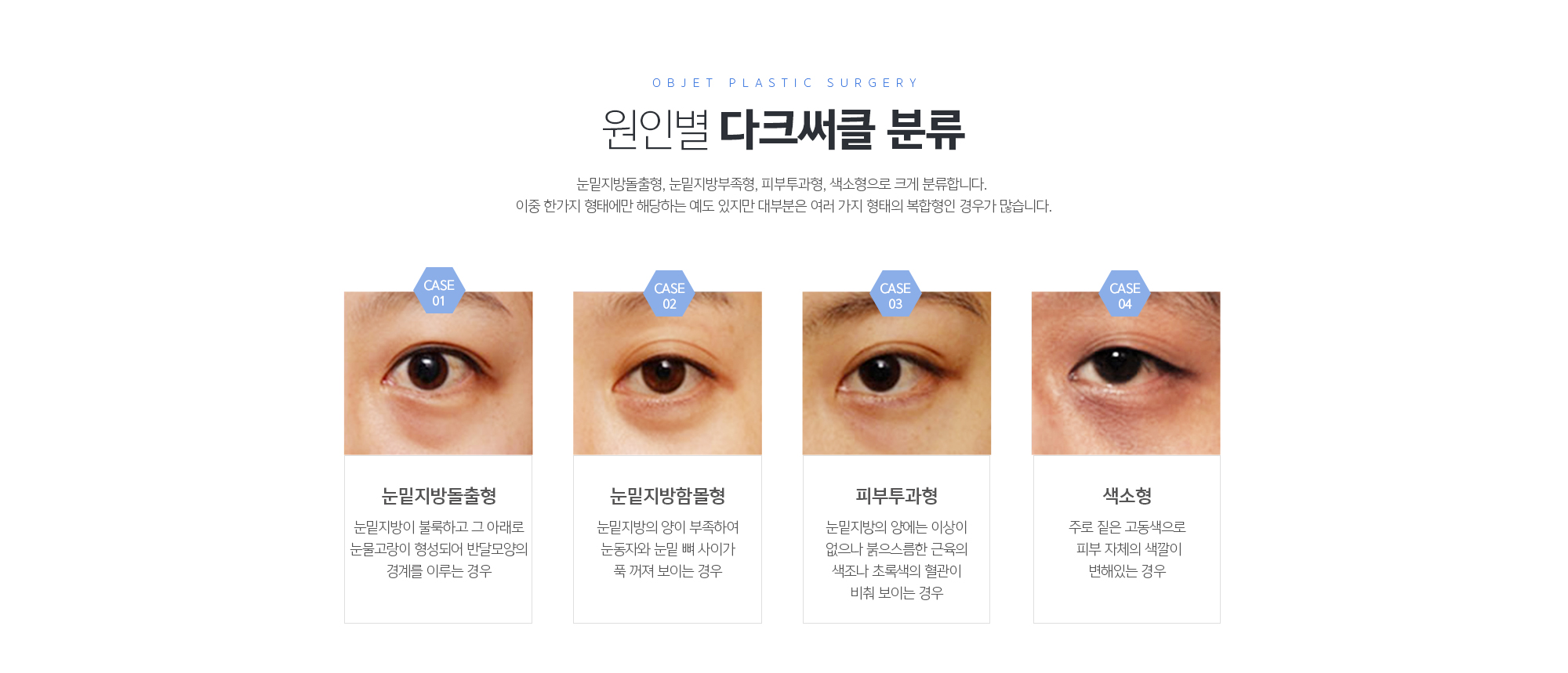 원인별 다크써클 분류
	눈밑지방돌출형, 눈밑지방부족형, 피부투과형, 색소형으로 크게 분류합니다. 
	이중 한가지 형태에만 해당하는 예도 있지만 대부분은 여러 가지 형태의 복합형인 경우가 많습니다.
	CASE 1
	눈밑지방돌출형
	눈밑지방이 불룩하고 그 아래로 눈물고랑이 형성되어 반달모양의 경계를 이루는 경우
	CASE 2
	눈밑지방함몰형
	눈밑지방의 양이 부족하여 눈동자와 눈밑 뼈 사이가 푹 꺼져 보이는 경우
	CASE 3
	피부투과형
	눈밑지방의 양에는 이상이 없으나 붉으스름한 근육의 색조나 초록색의 혈관이 비춰 보이는 경우
	CASE 4
	색소형
	주로 짙은 고동색으로 피부 자체의 색깔이 변해있는 경우
	