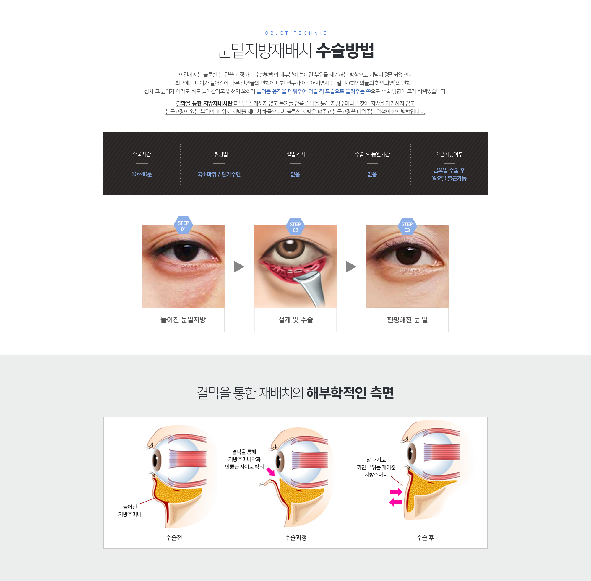 눈밑지방제거와 눈밑지방재배치 중 내게 필요한 눈 밑 성형은? 
	CASE 1. 눈밑지방제거가 필요한 경우
	CASE 2. 눈밑지방재배치가 필요한 경우 
	애교살이 기존에 있던 분들은 더 도드라질 수 있도록, 
	없던 분들은 애교살이 살아날 수 있도록, 
	얼굴이 전체적으로 어두워 보였던 분들은 눈매가 환해지면서 
	얼굴 전체적인 미백효과를 누릴 수 있도록 하는 ‘눈밑지방재배치’를 시행합니다. 
	