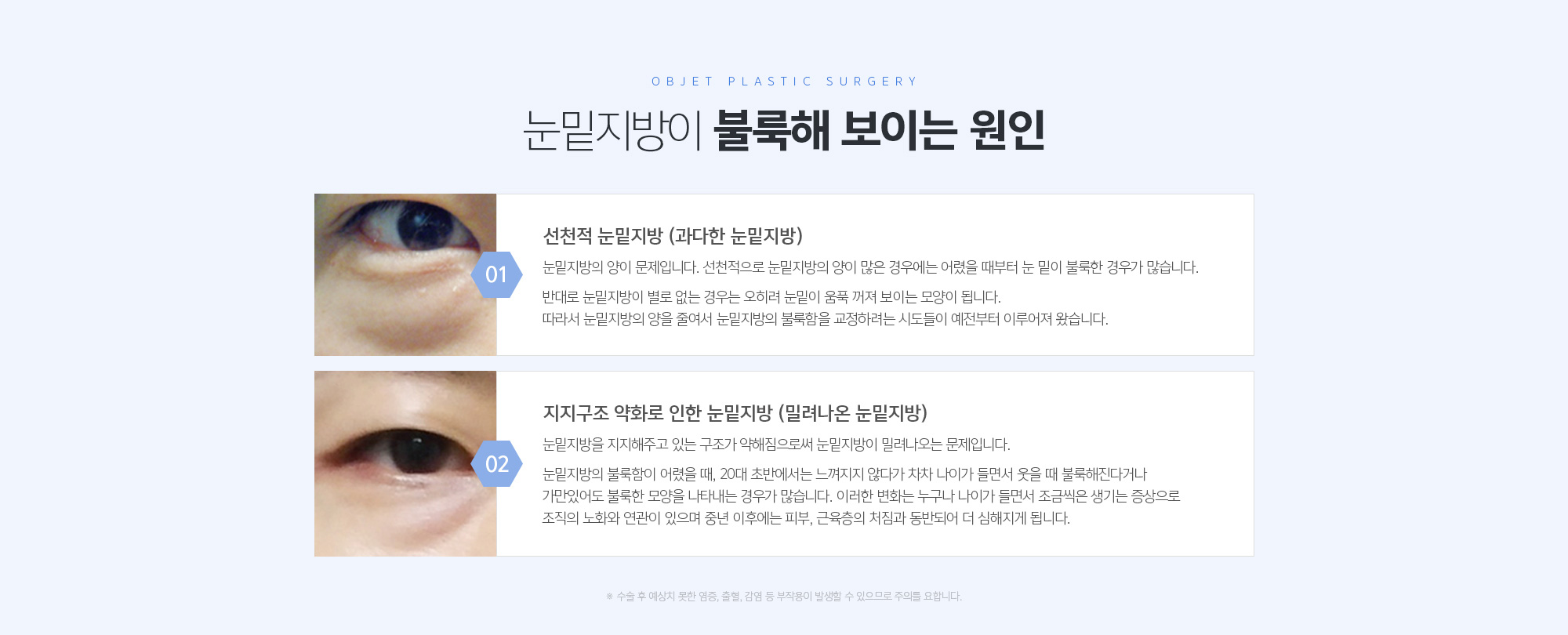 눈밑지방이 불룩해 보이는 원인
	선천적 눈밑지방 (과다한 눈밑지방)
	눈밑지방의 양이 문제입니다. 선천적으로 눈밑지방의 양이 많은 경우에는 어렸을 때부터 눈 밑이 불룩한 경우가 많습니다. 
	반대로 눈밑지방이 별로 없는 경우는 오히려 눈밑이 움푹 꺼져 보이는 모양이 됩니다. 따라서 눈밑지방의 양을 줄여서 눈밑지방의 불룩함을 교정하려는 시도들이 예전부터 이루어져 왔습니다.

	지지구조 약화로 인한 눈밑지방 (밀려나온 눈밑지방)
	눈밑지방을 지지해주고 있는 구조가 약해짐으로써 눈밑지방이 밀려나오는 문제입니다. 

	눈밑지방의 불룩함이 어렸을 때, 20대 초반에서는 느껴지지 않다가 차차 나이가 들면서 웃을 때 불룩해진다거나 가만있어도 불룩한 모양을 나타내는 경우가 많습니다. 이러한 변화는 누구나 나이가 들면서 조금씩은 생기는 증상으로 조직의 노화와 연관이 있으며 중년 이후에는 피부, 근육층의 처짐과 동반되어 더 심해지게 됩니다.
	