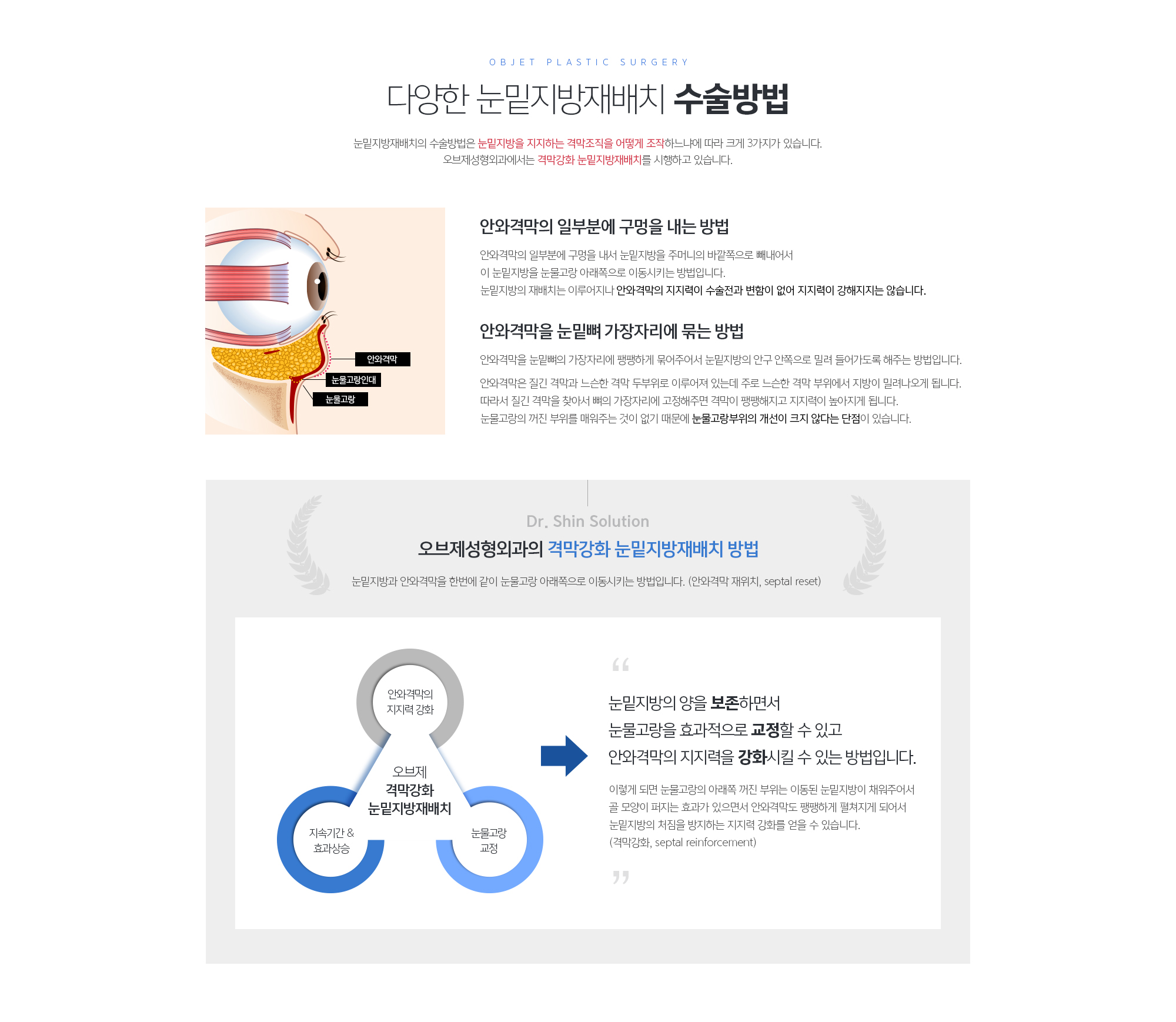 조앤신성형외과의 격막강화 눈밑지방재배치 방법
	눈밑지방과 안와격막을 한번에 같이 눈물고랑 아래쪽으로 이동시키는 방법입니다. (안와격막 재위치, septal reset) 
	눈밑지방의 양을 보존하면서 눈물고랑을 효과적으로 교정할 수 있고 안와격막의 지지력을 강화시킬 수 있는 방법입니다.
	이렇게 되면 눈물고랑의 아래쪽 꺼진 부위는 이동된 눈밑지방이 채워주어서 골 모양이 퍼지는 효과가 있으면서 안와격막도 팽팽하게 펼쳐지게 되어서 눈밑지방의 처짐을 방지하는 지지력 강화를 얻을 수 있습니다. (격막강화, septal reinforcement)
	
