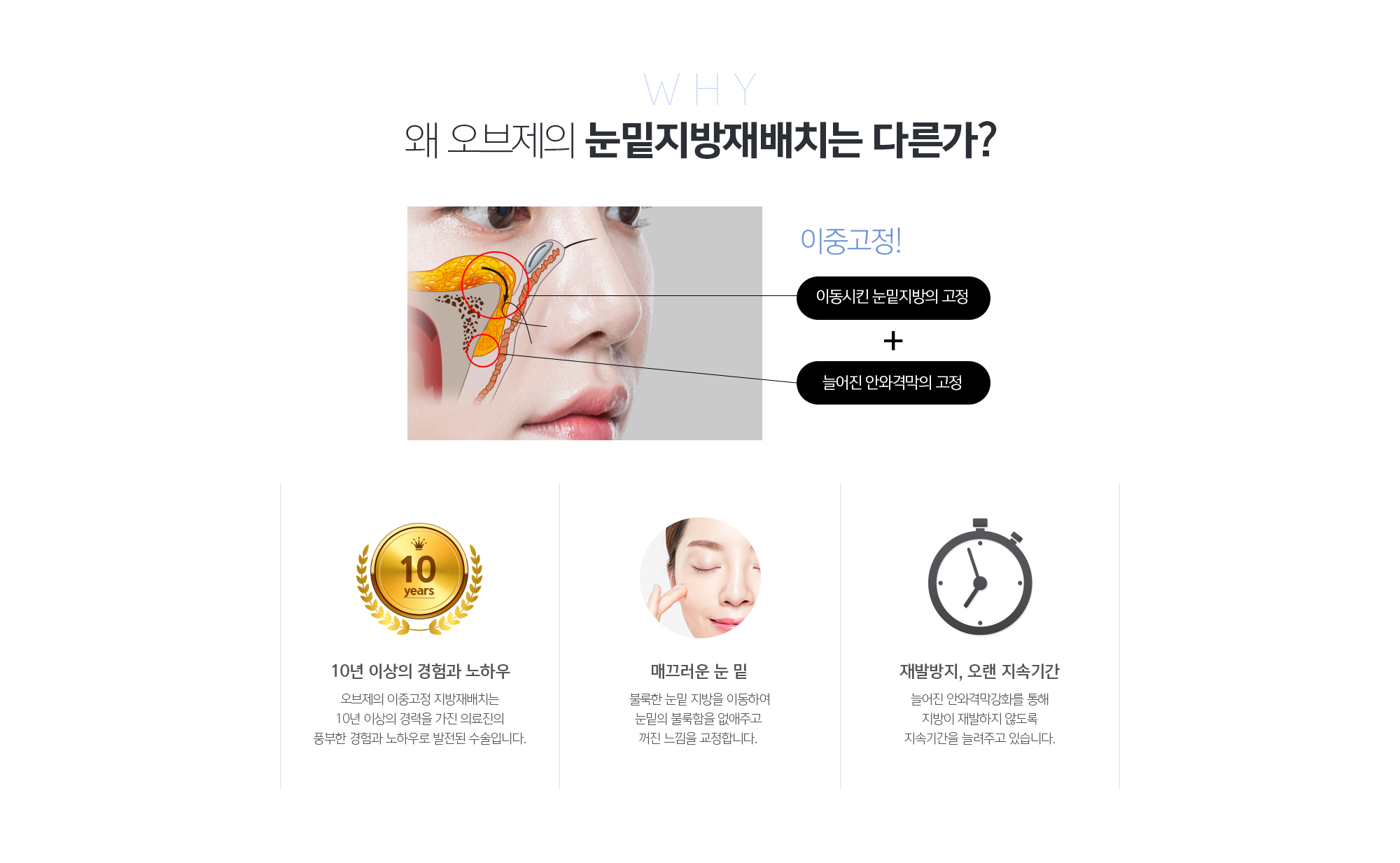 10년 이상의 경험과 노하우
	조앤신의 이중고정 지방재배치는 10년 이상의 경력을 가진 의료진의 풍부한 경험과 노하우로 발전된 수술입니다. 
	매끄러운 눈 밑
	불룩한 눈밑 지방을 이동하여 눈밑의 불룩함을 없애주고 꺼진 느낌을 교정합니다. 
	재발방지, 오랜 지속기간
	늘어진 안와격막강화를 통해 지방이 재발하지 않도록 지속기간을 늘려주고 있습니다.
	