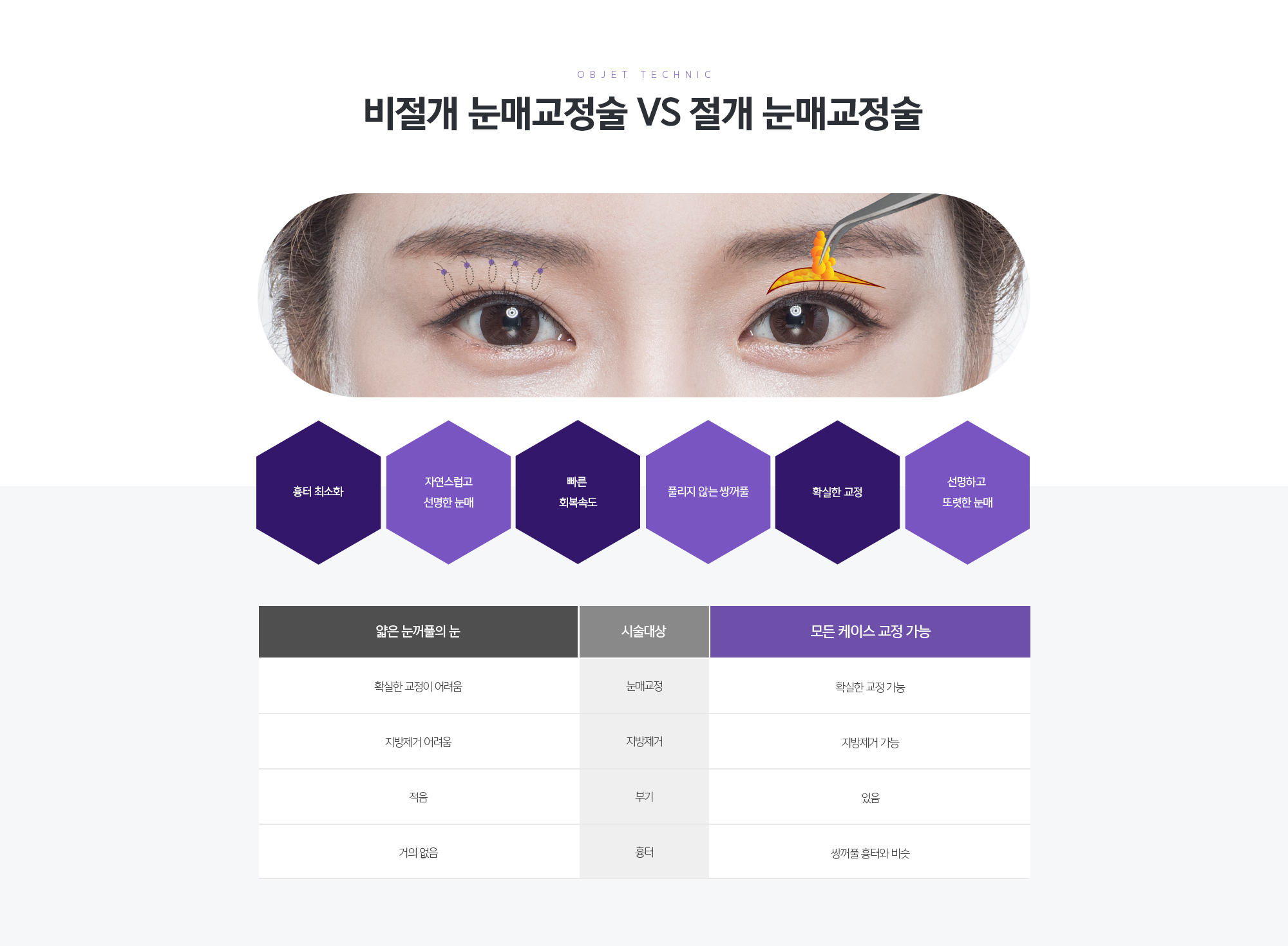 예쁜 눈을 결정짓는, 검은 눈동자의 노출량
	눈을 완전히 떴을 때 검은 눈동자가 80%이상 노출되어야 이상적인 눈입니다.
	눈을 떴을 때 검은 눈동자가 80% 이하, 눈꺼풀에서 눈동자가 1~2mm정도 밖에 노출이 되지 않을 경우 졸린 듯한 느낌과 피곤한 인상을 줍니다. 눈을 뜨는 힘이 부족하기 때문에 이마를 찡그리거나 눈썹을 들어올려 눈을 뜨므로 자연스럽지 못합니다.
	비절개 눈매교정술 VS 절개 눈매교정술
	