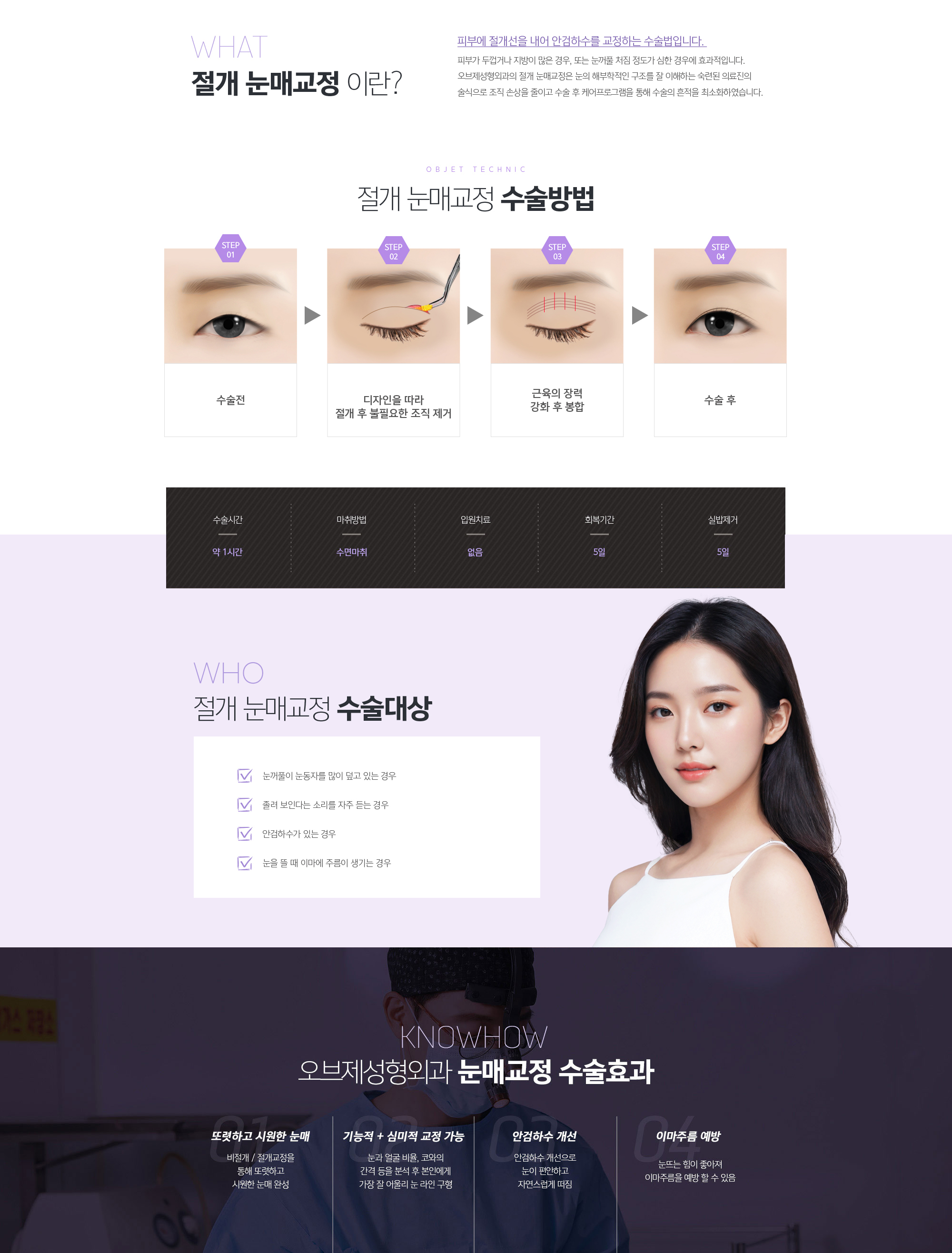 절개 눈매교정이란? 
				피부에 절개선을 내어 안검하수를 교정하는 수술법입니다. 
				피부가 두껍거나 지방이 많은 경우, 또는 눈꺼풀 처짐 정도가 심한 경우에 효과적입니다. 조앤신성형외과의 절개 눈매교정은 눈의 해부학적인 구조를 잘 이해하는 숙련된 의료진의 술식으로 조직 손상을 줄이고 수술 후 케어프로그램을 통해 수술의 흔적을 최소화하였습니다.
				절개 눈매교정 수술방법 
				수술전
				디자인을 따라 절개 후 불필요한 조직 제거
				근육의 장력 강화 후 봉합
				수술 후
				절개 눈매교정 수술대상
				1. 눈꺼풀이 눈동자를 많이 덮고 있는 경우
				2. 졸려 보인다는 소리를 자주 듣는 경우
				3. 안검하수가 있는 경우
				4. 눈을 뜰 때 이마에 주름이 생기는 경우
				