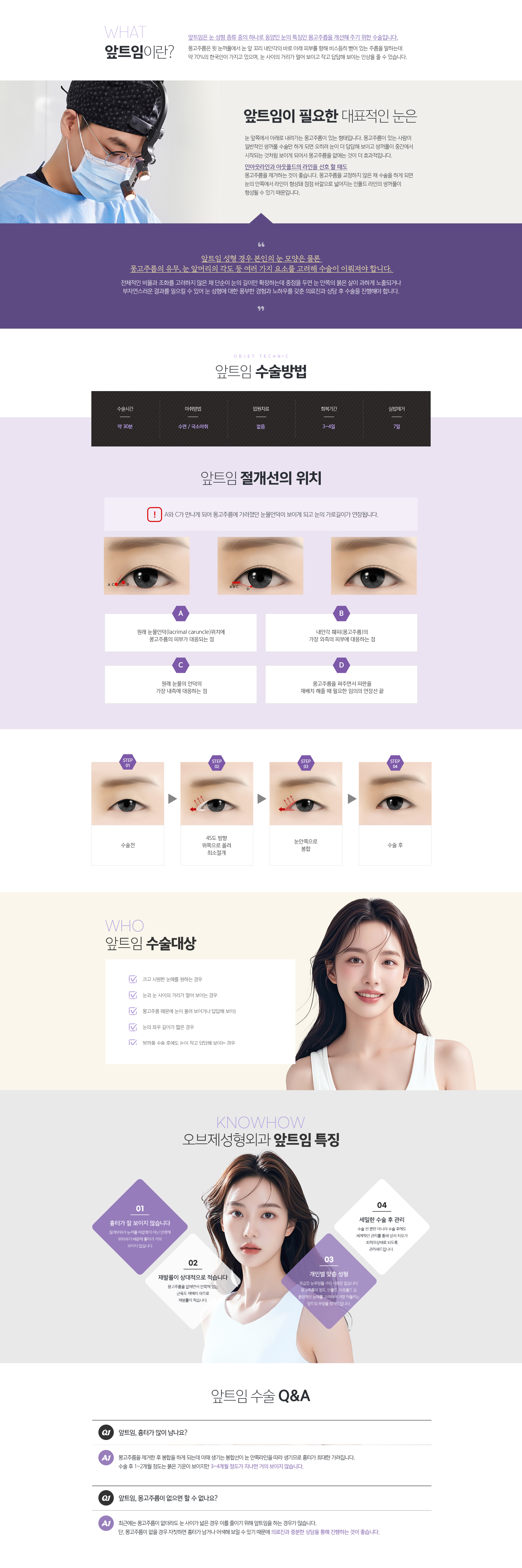 앞트임이란? 
				앞트임은 눈 성형 종류 중의 하나로 동양인 눈의 특징인 몽고주름을 개선해 주기 위한 수술입니다.
				몽고주름은 윗 눈꺼풀에서 눈 앞 꼬리 내안각의 바로 아래 피부를 향해 비스듬히 뻗어 있는 주름을 말하는데 약 70%의 한국인이 가지고 있으며, 눈 사이의 거리가 멀어 보이고 작고 답답해 보이는 인상을 줄 수 있습니다. 
				앞트임이 필요한 대표적인 눈은 
				눈 앞쪽에서 아래로 내려가는 몽고주름이 있는 형태입니다. 몽고주름이 있는 사람이 일반적인 쌍꺼풀 수술만 하게 되면 오히려 눈이 더 답답해 보이고 쌍꺼풀이 중간에서 시작되는 것처럼 보이게 되어서 몽고주름을 없애는 것이 더 효과적입니다. 
				인아웃라인과 아웃폴드의 라인을 선호 할 때도 몽고주름을 제거하는 것이 좋습니다. 몽고주름을 교정하지 않은 채 수술을 하게 되면 눈의 안쪽에서 라인이 형성돼 점점 바깥으로 넓어지는 인폴드 라인의 쌍꺼풀이 형성될 수 있기 때문입니다. 
				앞트임 성형 경우 본인의 눈 모양은 물론 
				몽고주름의 유무, 눈 앞머리의 각도 등 여러 가지 요소를 고려해 
				수술이 이뤄져야 합니다. 

				전체적인 비율과 조화를 고려하지 않은 채 단순이 눈의 길이만 확장하는데 중점을 두면 눈 안쪽의 붉은 살이 과하게 노출되거나 
				부자연스러운 결과를 일으킬 수 있어 눈 성형에 대한 풍부한 경험과 노하우를 갖춘 의료진과 상담 후 수술을 진행해야 합니다. 
				앞트임 수술방법 
				앞트임 절개선의 위치
				A와 C가 만나게 되어 몽고주름에 가려졌던 눈물언덕이 보이게 되고 눈의 가로길이가 연장된다. 
				원래 눈물언덕(lacrimal caruncle)위치에 
				몽고주름의 피부가 대응되는 점
				내안각 췌피(몽고주름)의 가장 외측의 피부에 대응하는 점
				원래 눈물의 언덕의 가장 내측에 대응하는 점
				몽고주름을 펴주면서 피판을 재배치 해줄 때 필요한 임의의 연장선 끝

				앞트임 수술대상
				1. 크고 시원한 눈매를 원하는 경우
				2. 눈과 눈 사이의 거리가 멀어 보이는 경우
				3. 몽고주름 때문에 눈이 몰려 보이거나 답답해 보이는 경우
				4. 눈의 좌우 길이가 짧은 경우
				5. 쌍꺼풀 수술 후에도 눈이 작고 답답해 보이는 경우
				
				조앤신성형외과 앞트임 특징
				01. 흉터가 잘 보이지 않습니다
				절개부위가 눈꺼풀 바깥쪽이 아닌 안쪽에 위치하기 때문에 흉터가 거의 보이지 않습니다.
				02. 재발률이 상대적으로 적습니다
				몽고주름을 없애면서 안쪽에 있는 근육도 재배치 하므로 재발률이 적습니다.
				03. 개인별 맞춤 성형
				똑같은 눈모양을 가진 사람은 없습니다. 몽고주름의 정도, 인폴드, 아웃폴드 등 종합적인 눈매를 고려하여 가장 어울리는 앞트임 모양을 찾아드립니다.
				04. 세밀한 수술 후 관리
				수술 전 뿐만 아니라 수술 후에도 체계적인 관리를 통해 상처 치유가 최적의 상태로 되도록 관리해드립니다.
				