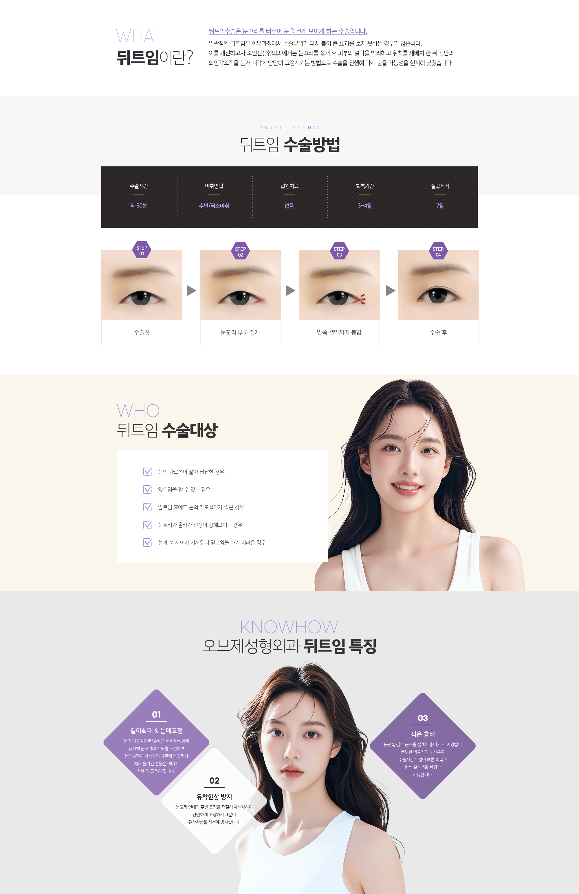 뒤트임이란? 
				뒤트임수술은 눈꼬리를 터주어 눈을 크게 보이게 하는 수술입니다.
				일반적인 뒤트임은 회복과정에서 수술부위가 다시 붙어 큰 효과를 보지 못하는 경우가 많습니다. 이를 개선하고자 조앤신성형외과에서는 눈꼬리를 절개 후 피부와 결막을 박리하고 위치를 재배치 한 뒤 검판과 외인각조직을 눈가 뼈막에 단단히 고정시키는 방법으로 수술을 진행해 다시 붙을 가능성을 현저히 낮췄습니다.

				눈꼬리의 위치에 따른 수술방법
				눈꼬리가 올라가서, 
				눈꼬리의 높이 이동이 필요한 경우
				눈꼬리가 올라가지 않아서
				눈꼬리 높이 이동이 필요없는 경우

				뒤트임 수술대상
				눈의 가로폭이 짧아 답답한 경우
				앞트임을 할 수 없는 경우 
				앞트임 후에도 눈의 가로길이가 짧은 경우
				눈꼬리가 올라가 인상이 강해보이는 경우
				눈과 눈 사이가 가까워서 앞트임을 하기 어려운 경우

				조앤신성형외과 뒤트임 특징
				01. 길이확대 & 눈매교정
				눈의 가로길이를 넓혀 큰눈을 완성함과 동시에 눈꼬리의 각도를 조절하여 눈매교정이 가능하기 때문에 눈꼬리가 치켜 올라간 분들은 이미지 변화에 도움이 됩니다.
				02. 유착현상 방지
				눈꼬리 인대와 주변 조직을 적절히 재배치하여 단단하게 고정하기 때문에 유착현상을 사전에 방지합니다.
				03. 적은 흉터
				눈안쪽 결막 근처를 절개해 흉터가 적고 경험이 풍부한 의료진의 노하우로 수술시간이 짧아 빠른 회복과 함께 일상생활 복귀가 가능합니다.
				