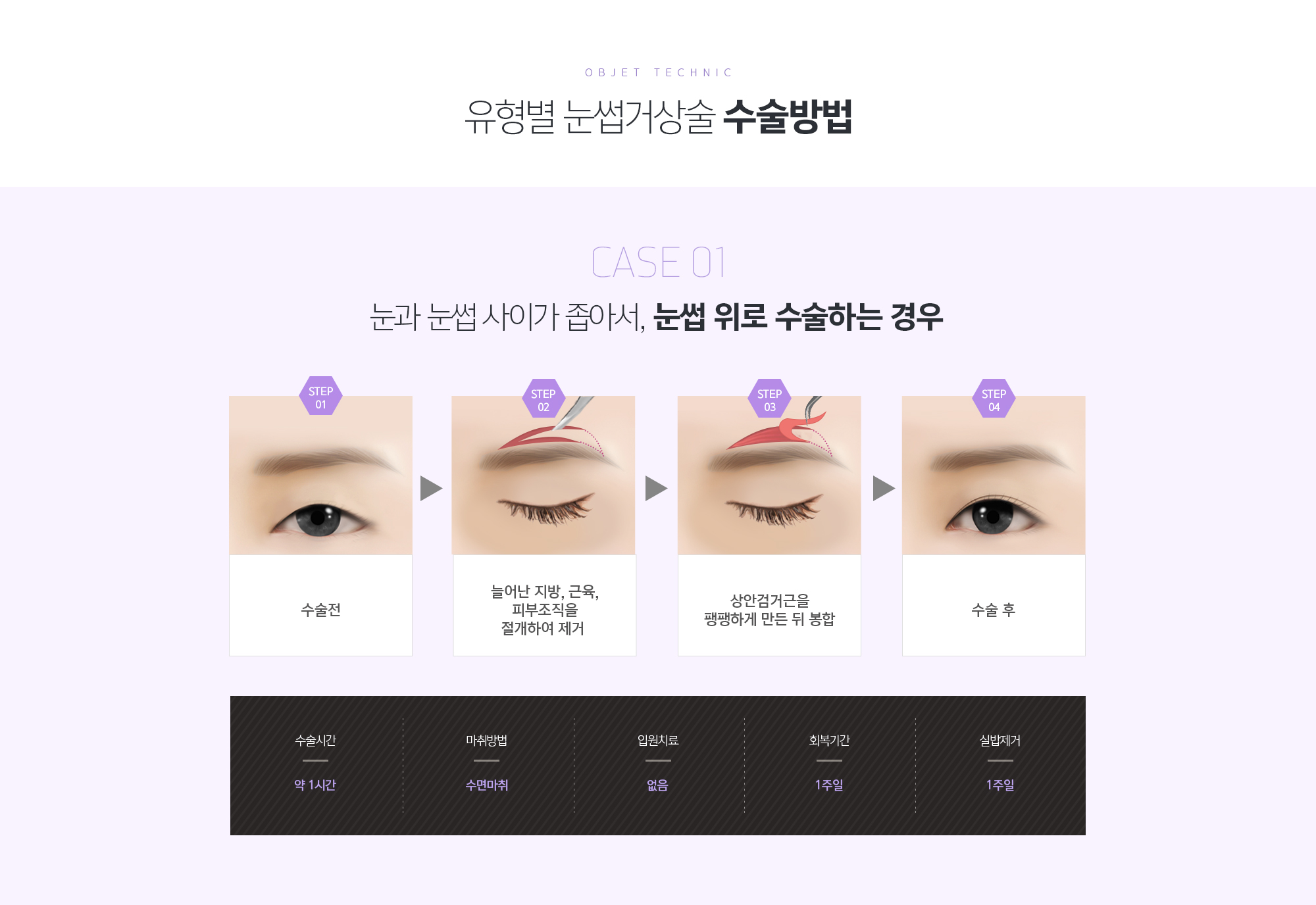 유형별 눈썹거상술 수술방법
	CASE 01
	눈과 눈썹 사이가 좁아서,눈썹 위로 수술하는 경우  

	CASE 02
	눈과 눈썹 사이가 넓어서,눈썹 아래로 수술하는 경우  
	