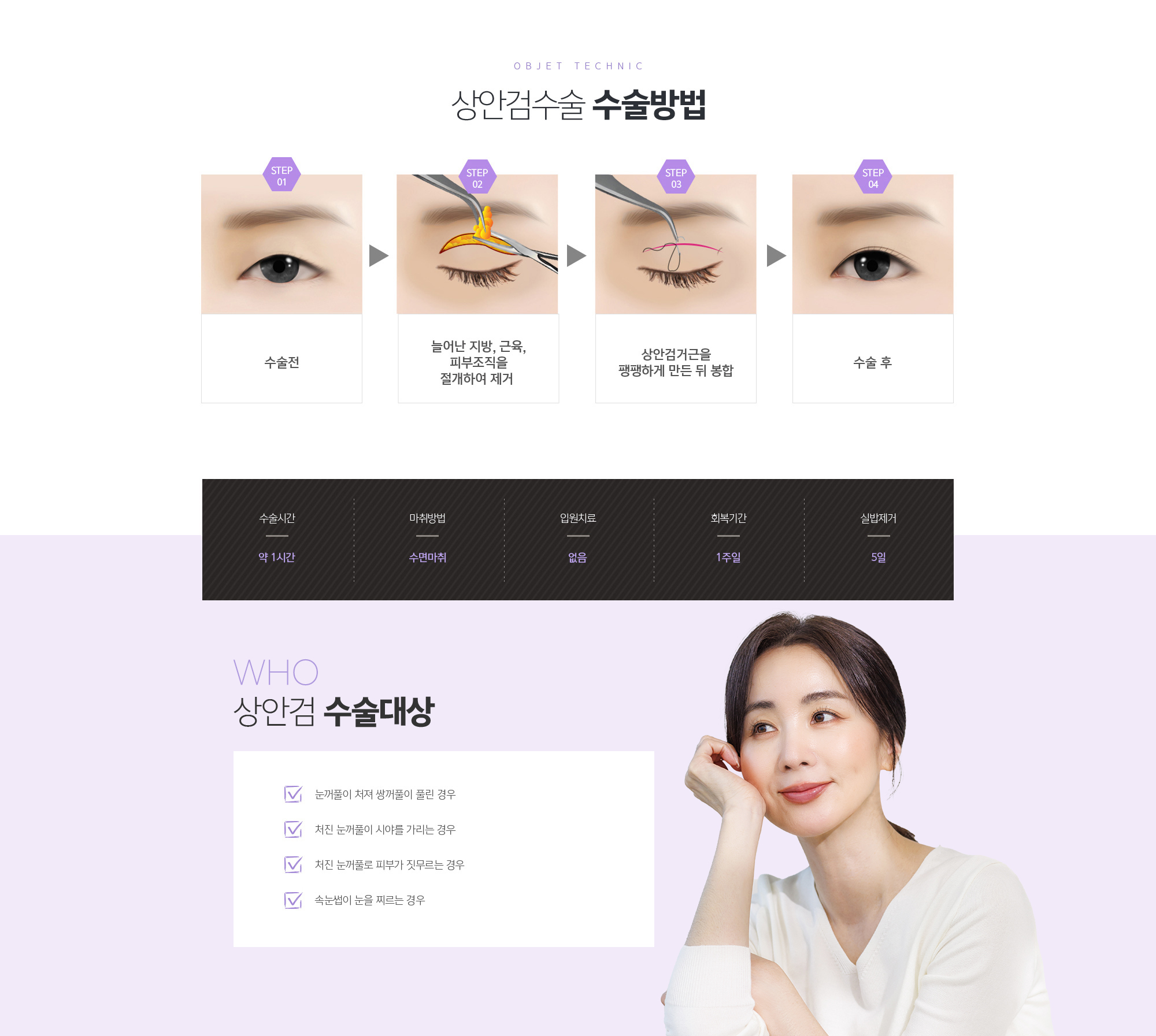 상안검 수술대상
	1. 눈꺼풀이 처져 쌍꺼풀이 풀린 경우
	2. 처진 눈꺼풀이 시야를 가리는 경우
	3. 처진 눈꺼풀로 피부가 짓무르는 경우
	4. 속눈썹이 눈을 찌르는 경우
	