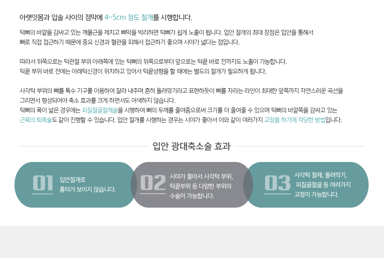 아랫잇몸과 입술 사이의 점막에 4~5cm 정도 절개를 시행합니다. 
				턱뼈의 바깥을 감싸고 있는 깨물근을 제치고 뼈막을 박리하면 턱뼈가 쉽게 노출이 됩니다. 입안 절개의 최대 장점은 입안을 통해서 뼈로 직접 접근하기 때문에 중요 신경과 혈관을 피해서 접근하기 좋으며 시야가 넓다는 점입니다. 

				따라서 뒤쪽으로는 턱관절 부위 아래쪽에 있는 턱뼈의 뒤쪽으로부터 앞으로는 턱끝 바로 전까지도 노출이 가능합니다. 턱끝 부위 바로 전에는 아래턱신경이 위치하고 있어서 턱끝성형을 할 때에는 별도의 절개가 필요하게 됩니다. 

				사각턱 부위의 뼈를 특수 기구를 이용하여 잘라 내주며 흔히 돌려깎기라고 표현하듯이 뼈를 자라는 라인이 최대한 앞쪽까지 자연스러운 곡선을 그리면서 형성되어야 축소 효과를 크게 하면서도 어색하지 않습니다. 턱뼈의 폭이 넓은 경우에는 피질절골절제술을 시행하여 뼈의 두께를 줄여줌으로써 크기를 더 줄여줄 수 있으며 턱뼈의 바깥쪽을 감싸고 있는 근육의 퇴축술도 같이 진행할 수 있습니다. 입안 절개를 시행하는 경우는 시야가 좋아서 이와 같이 여러가지 교정을 하기에 적당한 방법입니다.
				