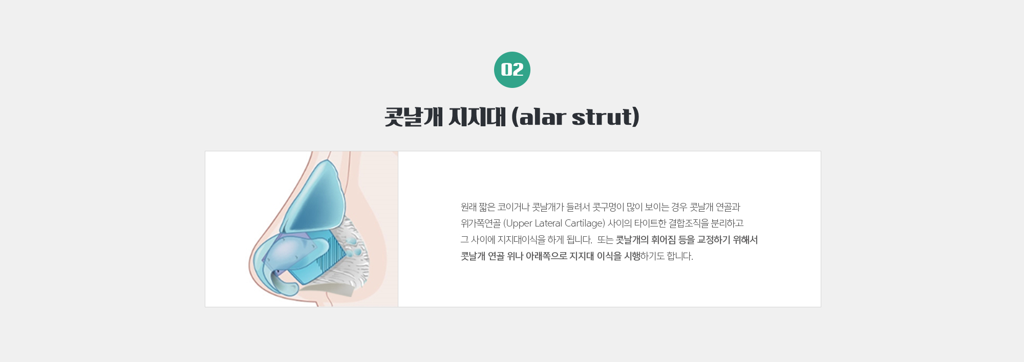 콧날개 지지대 (alar strut)
	원래 짧은 코이거나 콧날개가 들려서 콧구멍이 많이 보이는 경우 콧날개 연골과 위가쪽연골 (Upper Lateral Cartilage) 사이의 타이트한 결합조직을 분리하고 그 사이에 지지대이식을 하게 됩니다. 또는 콧날개의 휘어짐 등을 교정하기 위해서 콧날개 연골 위나 아래쪽으로 지지대 이식을 시행하기도 합니다.
	