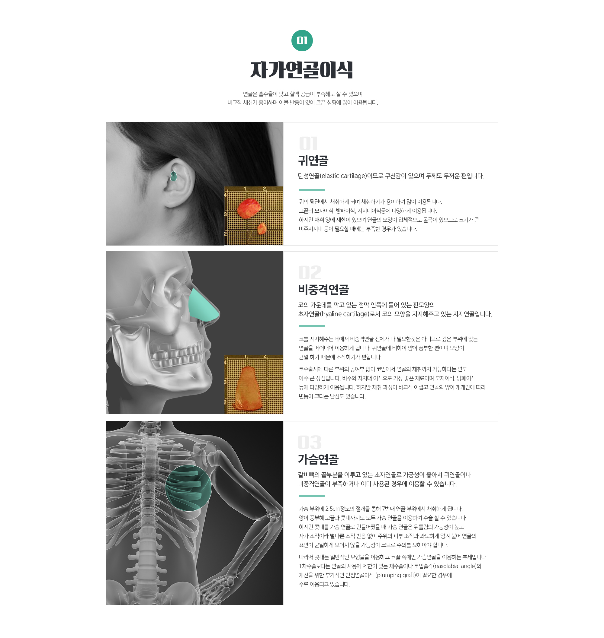 자가연골이식
	연골은 흡수율이 낮고 혈액 공급이 부족해도 살 수 있으며 비교적 채취가 용이하며 이물 반응이 없어 코끝 성형에 많이 이용됩니다.
	01. 귀연골
	탄성연골(elastic cartilage)이므로 쿠션감이 있으며 두께도 두꺼운 편입니다. 
	귀의 뒷면에서 채취하게 되며 채취하기가 용이하여 많이 이용됩니다. 코끝의 모자이식, 방패이식, 지지대이식등에 다양하게 이용됩니다. 하지만 채취 양에 제한이 있으며 연골의 모양이 입체적으로 굴곡이 있으므로 크기가 큰 비주지지대 등이 필요할 때에는 부족한 경우가 있습니다.

	02. 비중격연골
	코의 가운데를 막고 있는 점막 안쪽에 들어 있는 판모양의 초자연골(hyaline cartilage)로서 코의 모양을 지지해주고 있는 지지연골입니다. 
	코를 지지해주는 데에서 비중격연골 전체가 다 필요한것은 아니므로 깊은 부위에 있는 연골을 떼어내어 이용하게 됩니다. 귀연골에 비하여 양이 풍부한 편이며 모양이 균일 하기 때문에 조작하기가 편합니다. 
	코수술시에 다른 부위의 공여부 없이 코안에서 연골의 채취까지 가능하다는 면도 아주 큰 장점입니다. 비주의 지지대 이식으로 가장 좋은 재료이며 모자이식, 방패이식 등에 다양하게 이용됩니다. 하지만 채취 과정이 비교적 어렵고 연골의 양이 개개인에 따라 변동이 크다는 단점도 있습니다.

	03. 가슴연골
	갈비뼈의 끝부분을 이루고 있는 초자연골로 가공성이 좋아서 귀연골이나 비중격연골이 부족하거나 이미 사용된 경우에 이용할 수 있습니다. 
	가슴 부위에 2.5cm정도의 절개를 통해 7번째 연골 부위에서 채취하게 됩니다. 양이 풍부해 코끝과 콧대까지도 모두 가슴 연골을 이용하여 수술 할 수 있습니다. 하지만 콧대를 가슴 연골로 만들어줬을 때 가슴 연골은 뒤틀림의 가능성이 높고 자가 조직이라 별다른 조직 반응 없이 주위의 피부 조직과 과도하게 엉겨 붙어 연골의 표면이 균일하게 보이지 않을 가능성이 크므로 주의를 요하여야 합니다. 
	따라서 콧대는 일반적인 보형물을 이용하고 코끝 쪽에만 가슴연골을 이용하는 추세입니다. 1차수술보다는 연골의 사용에 제한이 있는 재수술이나 코입술각(nasolabial angle)의 개선을 위한 부가적인 받침연골이식 (plumping graft)이 필요한 경우에 주로 이용되고 있습니다.
	