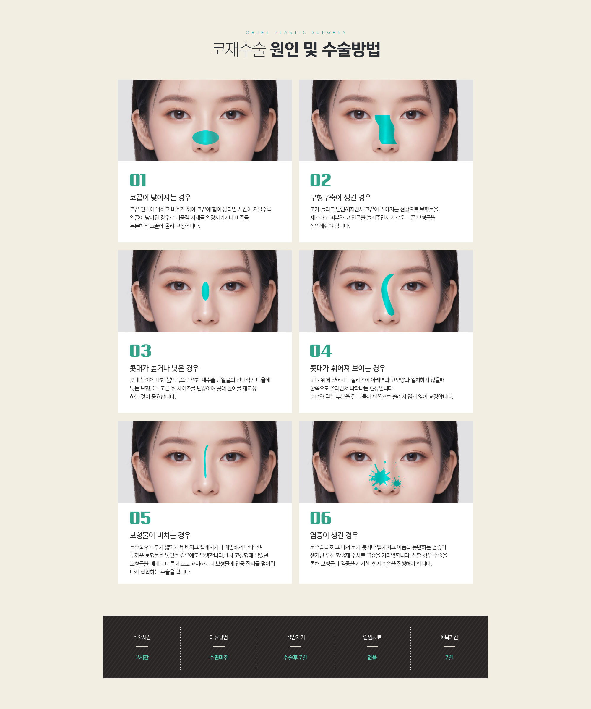 코재수술 원인 및 수술방법
	CASE 1. 코끝이 낮아지는 경우
	코끝 연골이 약하고 비주가 짧아 코끝에 힘이 없다면 시간이 지날수록 연골이 낮아진 경우로 비중격 자체를 연장시키거나 비주를 튼튼하게 코끝에 올려 교정합니다.
	CASE 2. 구형구축이 생긴 경우
	코가 들리고 단단해지면서 코끝이 짧아지는 현상으로 보형물을 제거하고 피부와 코 연골을 눌러주면서 새로운 코끝 보형물을 삽입해줘야 합니다.
	CASE 3. 콧대가 높거나 낮은 경우
	콧대 높이에 대한 불만족으로 인한 재수술로 얼굴의 전반적인 비율에 맞는 보형물을 고른 뒤 사이즈를 변경하여 콧대 높이를 재 교정 하는 것이 중요합니다.
	CASE 4. 콧대가 휘어져 보이는 경우
	코뼈 위에 얹어지는 실리콘이 아래면과 코모양과 일치하지 않을때 한쪽으로 쏠리면서 나타나는 현상입니다. 코뼈와 닿는 부분을 잘 다듬어 한쪽으로 쏠리지 않게 앉어 교정합니다.
	CASE 5. 보형물이 비치는 경우
	코수술후 피부가 얇아져서 비치고 빨개지거나 예민해서 나타나며 두꺼운 보형물을 넣었을 경우에도 발생합니다. 1차 코성형때 넣었던 보형물을 빼내고 다른 재료로 교체하거나 보형물에 인공 진피를 덮어줘 다시 삽입하는 수술을 합니다.
	CASE 6. 염증이 생긴 경우
	코수술을 하고 나서 코가 붓거나 빨개지고 아픔을 동반하는 염증이 생기면 우선 항생제 주사로 염증을 가라앉힙니다. 심할 경우 수술을 통해 보형물과 염증을 제거한 후 재수술을 진행해야 합니다.
	CASE 7. 보형물이 움직이는 경우
	보형물이 코뼈와 골막 사이에 정착을 못하게 되면 손으로 만졌을 때 보형물이 움직이게 됩니다. 이럴 경우 보형물을 다시 뺀 뒤 뼈와 골막 하에 삽입하거나 보형물을 변경하는 방법으로 교정합니다.
	