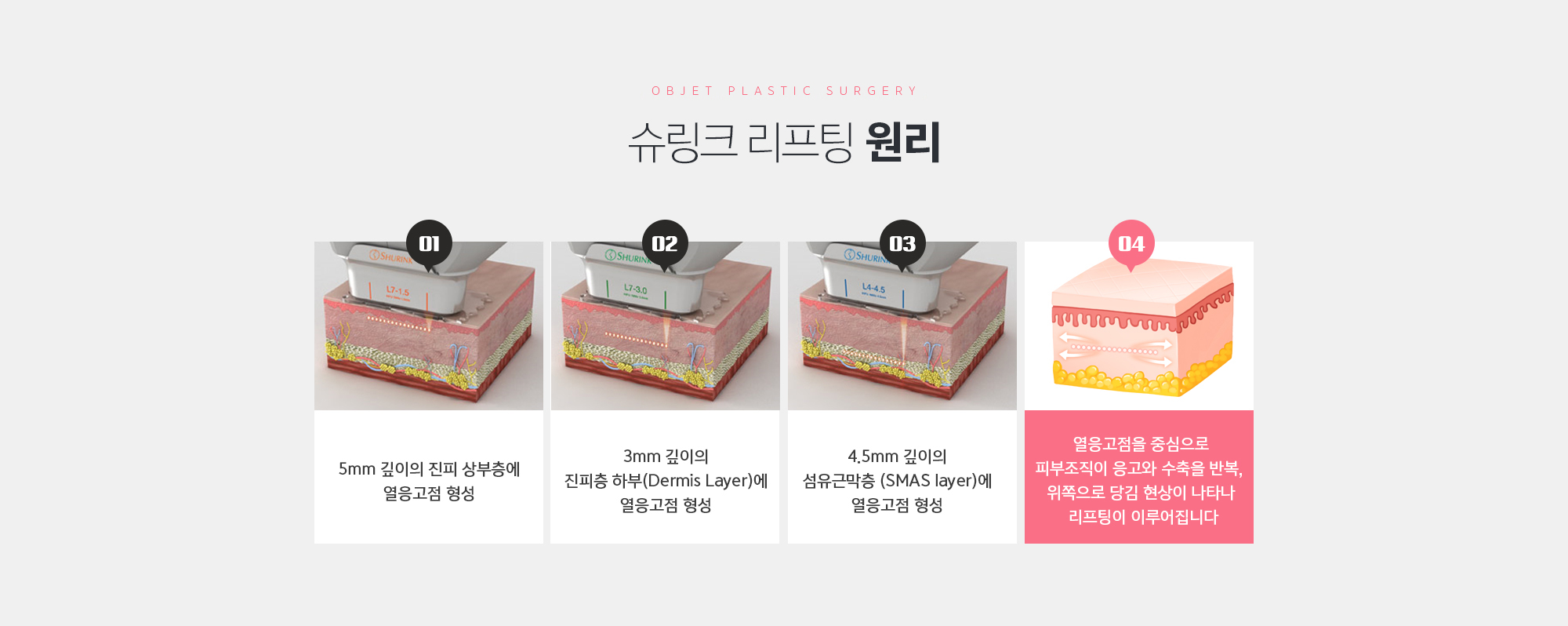 슈링크 리프팅의 원리
	열 응고점을 중심으로 피부 조직이 응고되고 수축되어 위쪽으로 
	당김 현상이 나타나 리프팅이 이루어지게 됩니다
	